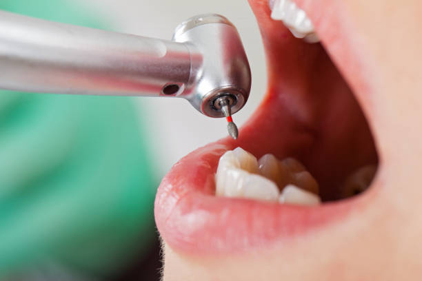 Best Pediatric Emergency Dentist in Binghamton University, NY